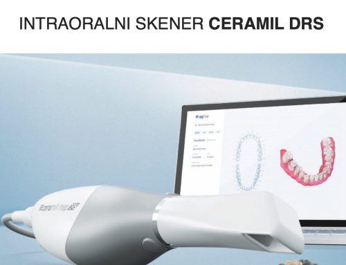 AG Ceramill DRS – intraoralni skener