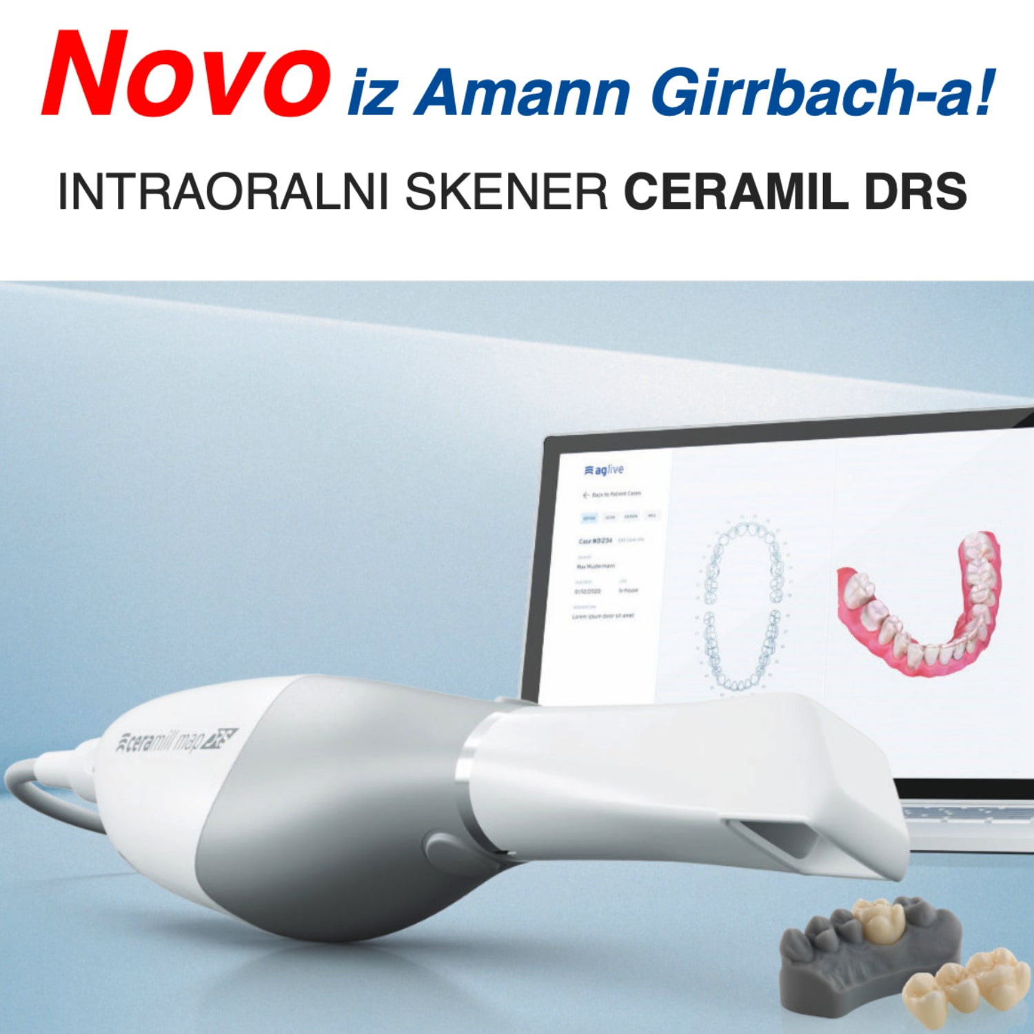 AG Ceramill DRS - intraoralni skener