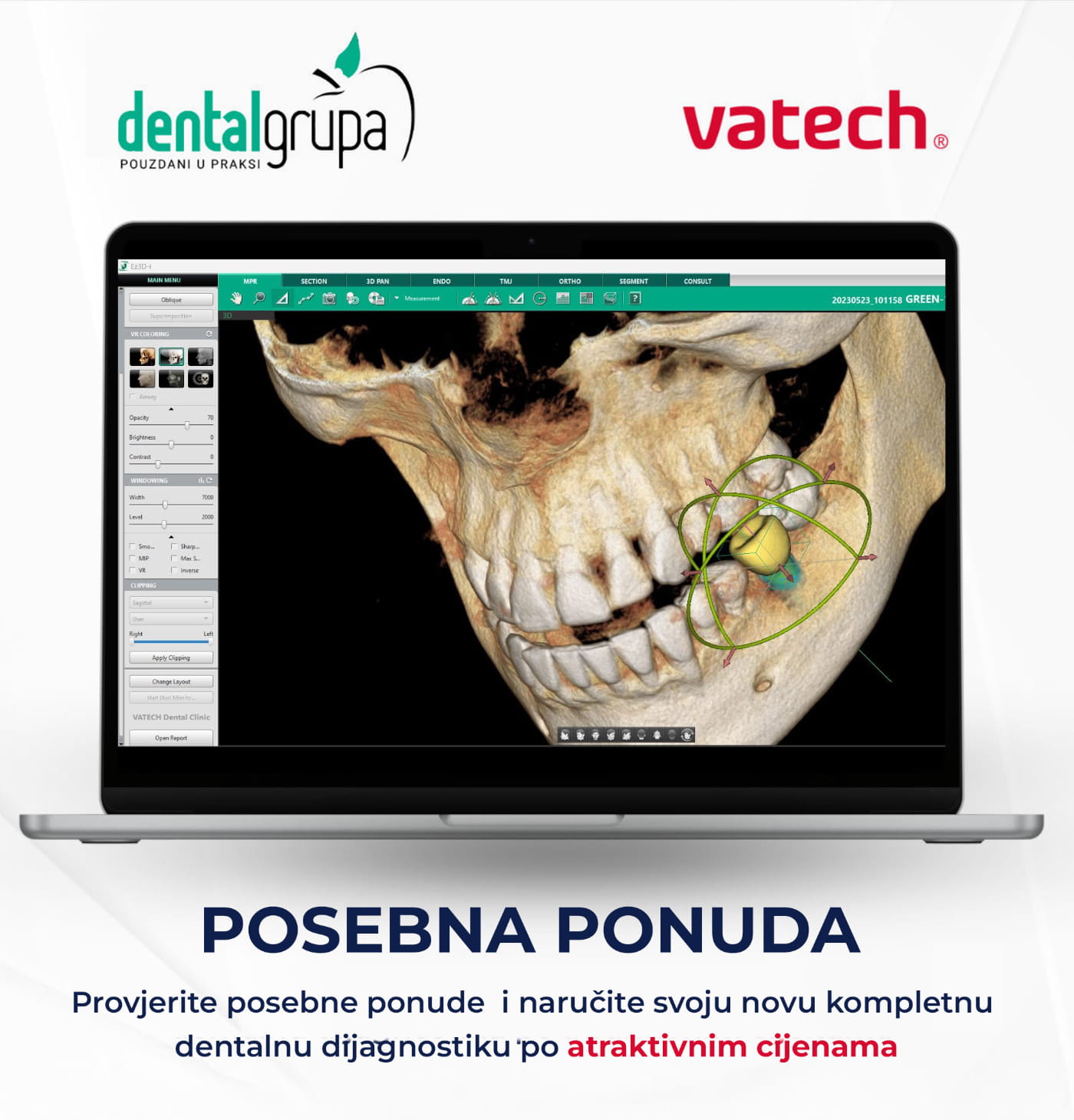 Posebna ponuda za kompletne Vatech pakete: A9 & Green X12 SE
